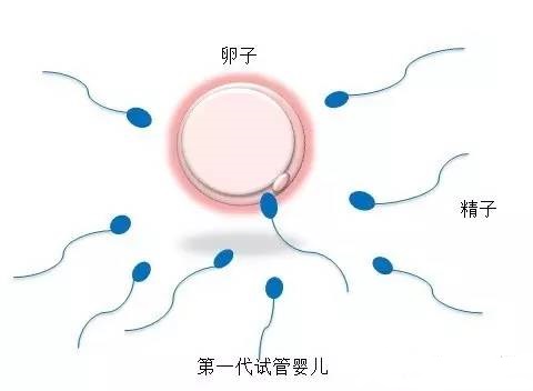 关于极光